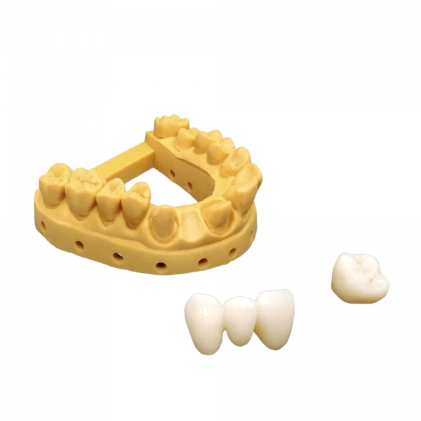 Jamg He Temp Crowns & Bridges - Image 2