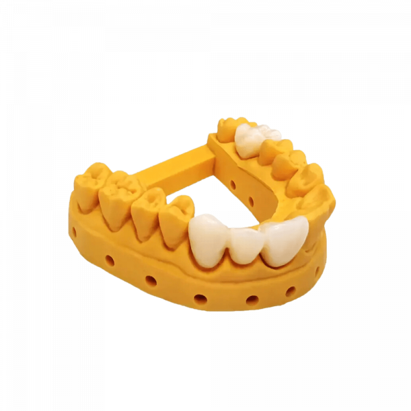 Jamg He Temp Crowns & Bridges - Image 3