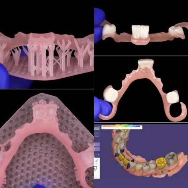 Senertek Denture Flexo - Image 3
