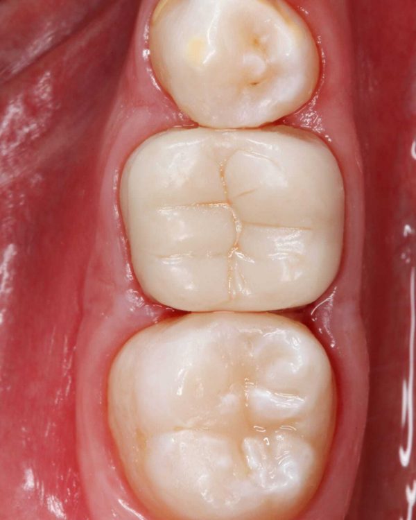Senertek P-Crown - Image 2